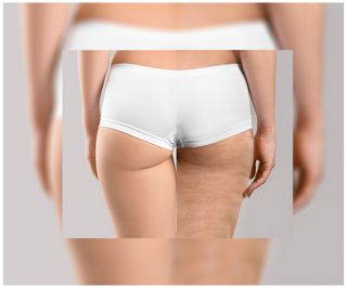 Tabletten gegen Cellulite und für Verbesserung der Kondition der Haut mit natürlichen Extrakten Cellinea 60 Kapseln