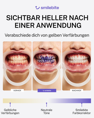 White Bite Smilebite Corrector zur Korrektur der Zahnfarbe 30 ml - 4