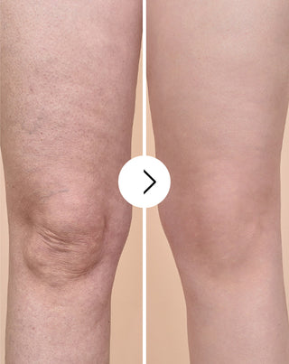 Tabletten gegen Cellulite und für Verbesserung der Kondition der Haut mit natürlichen Extrakten Cellinea 60 Kapseln