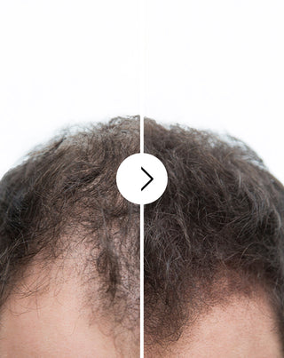 Kapseln gegen Haarausfall mit verdichtender und stärkender Wirkung Follixin 60 Kapseln - 6