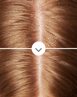 Anti-Schuppen-Shampoo von Nutridome mit Pirocton-Olamin und feuchtigkeitsspendender Wirkung - 2