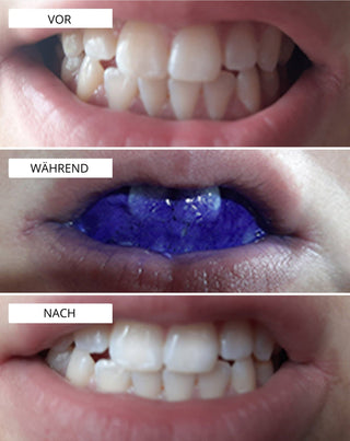 White Bite Smilebite Corrector zur Korrektur der Zahnfarbe 30 ml - 3