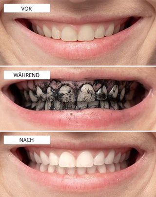 Smilebite Zahnaufhellungspulver mit Kokosnusskohle - 4