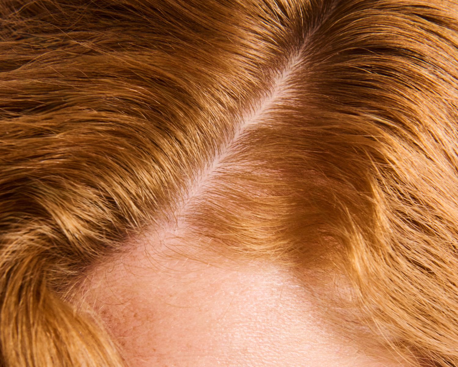 Warum ist die Kopfhaut so wichtig?