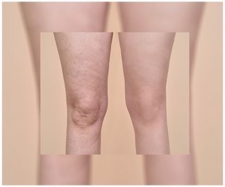 Tabletten gegen Cellulite und für Verbesserung der Kondition der Haut mit natürlichen Extrakten Cellinea 60 Kapseln - 6