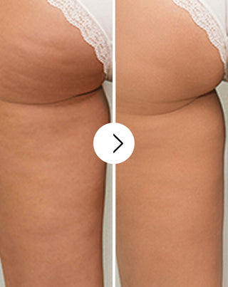 Tabletten gegen Cellulite und für Verbesserung der Kondition der Haut mit natürlichen Extrakten Cellinea 60 Kapseln - 5