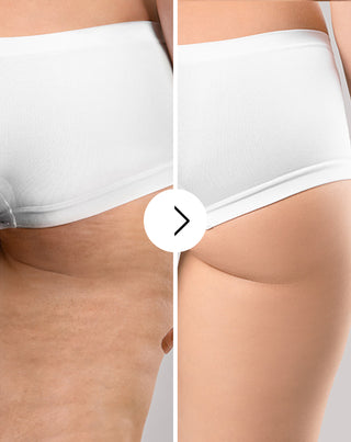 Tabletten gegen Cellulite und für Verbesserung der Kondition der Haut mit natürlichen Extrakten Cellinea 60 Kapseln - 6