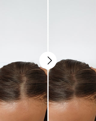 Kapseln gegen Haarausfall mit verdichtender und stärkender Wirkung Follixin 60 Kapseln
