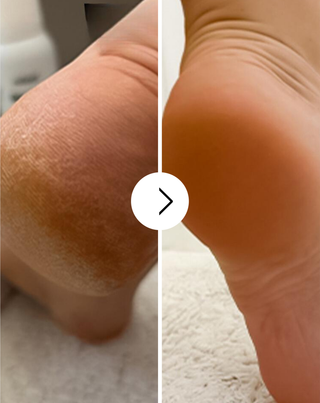 Nutridome weichmachende Fußcreme mit Urea und Sheabutter